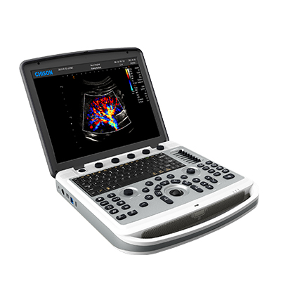 Ультразвуковий апарат SonoBook 6
