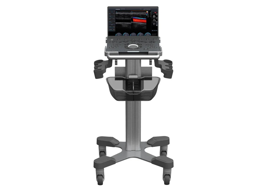 УЗД апарат SonoAir 70 